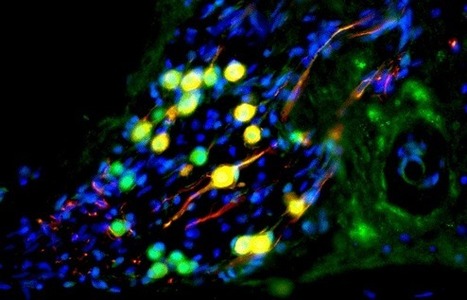 Human stem cells cure common form of deafness | KurzweilAI | Longevity science | Scoop.it