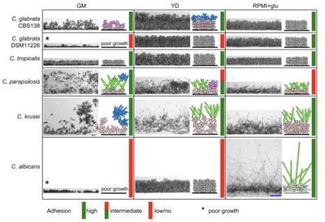 Spatial structure of yeast biofilms and the role of cell adhesion across different media | bfm | RMH | Scoop.it