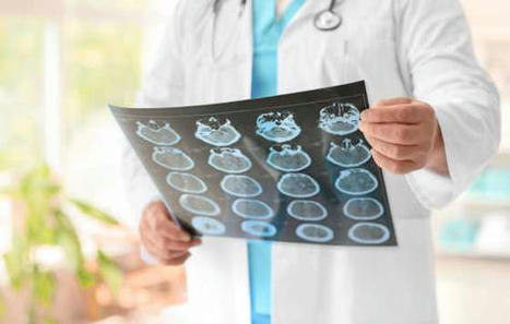 Altos niveles de masa magra pueden proteger contra el Alzheimer | Alzheimer y más (Boletín nº 79) | Scoop.it