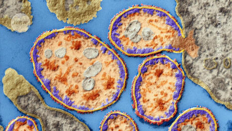 This scientist treated her own cancer with viruses she grew in the lab - Nature | Genetic Engineering in the Press by GEG | Scoop.it