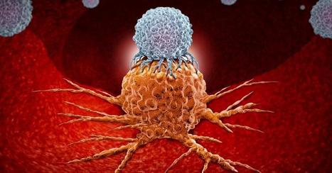 Measles is a natural cancer killer | Health Supreme | Scoop.it