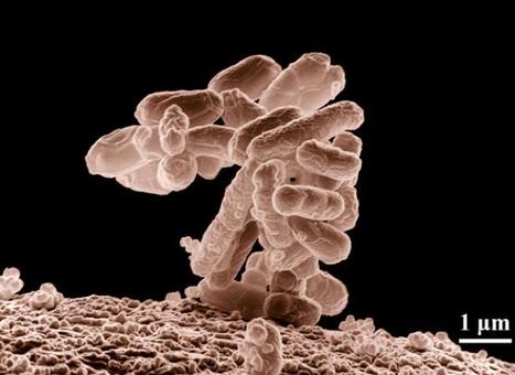 Bactérie tueuse: La responsabilité des graines germées confirmée | 20Minutes.fr | Toxique, soyons vigilant ! | Scoop.it