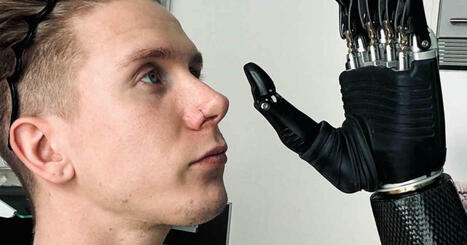 Antti Ahtilinnalla on yli 20 000 euron robottikäsi – näin toimii uusinta teknologiaa oleva proteesi | Yle Lume | Yle | 1Uutiset - Lukemisen tähden | Scoop.it