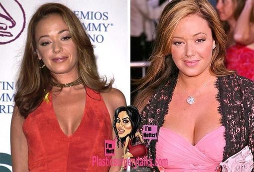 Leah Remini Plastic Surgery Before & After
