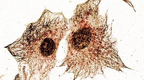 STING, une prot&eacute;ine aux multiples visages, de l&rsquo;immunit&eacute; au m&eacute;tabolisme | CARINE MEIGNIN | Immunology | Scoop.it
