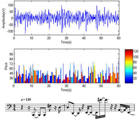 Musical brain patterns could help predict epileptic seizures | Science News | Scoop.it