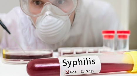 Loi de Murphy : la syphilis resurgit au moment où son médicament disparaît | sida | Scoop.it