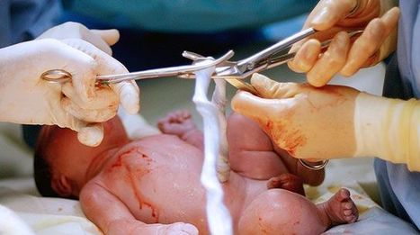 Lotus Birth To Blame for Death of Australian Newborn – Science-Based Medicine | Escepticismo y pensamiento crítico | Scoop.it