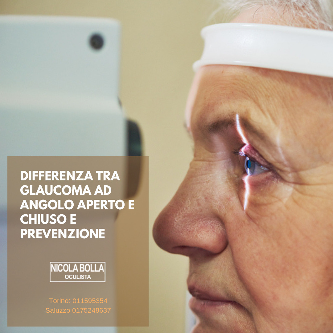 Glaucoma Cause E Cura Oculista Torino Dr