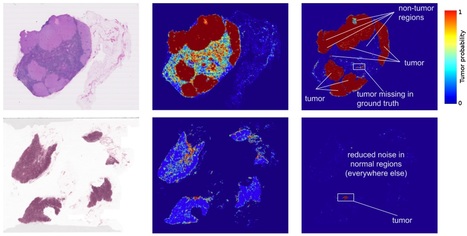 An Augmented Reality Microscope for Cancer Detection | Amazing Science | Scoop.it
