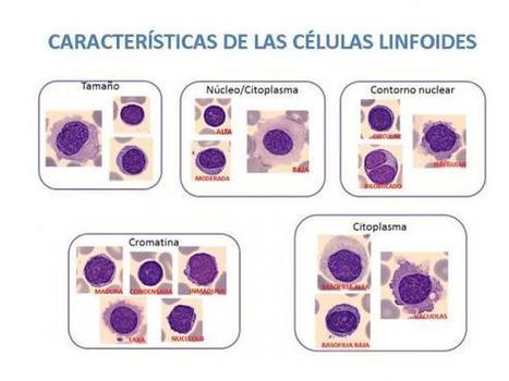 Herramienta diagnóstica en leucemias y linfomas: en búsqueda de financiación | Immunology Diagnosis | Scoop.it