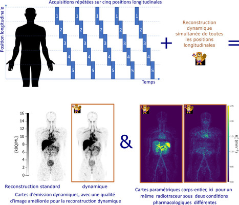 FOCUS PLATEFORME : L’imagerie hybride dynamique corps-entier TEP-IRM, un nouvel outil pour la pharmacologie ? | Life Sciences Université Paris-Saclay | Scoop.it