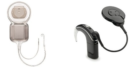 Cochlear annonce Nucleus Profil Plus et améliore la connectivité de ses implants  aux USA | Revue de presse Implant Cochléaire | Scoop.it
