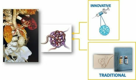 Onyx Gel or Coil versus Hydrogel as Embolic Agents in Endovascular Applications: Review of the Literature and Case Series | Neurovascular Intervention | Scoop.it