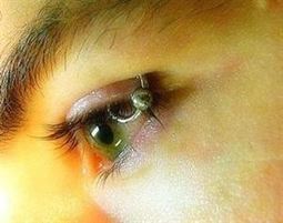 Los 'piercings' en las cejas y párpados pueden provocar lesiones en los ojos | Salud Visual 2.0 | Scoop.it