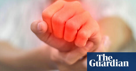 Autoimmune disease may almost double risk of mental ill health, study suggests. | Hospitals and Healthcare | Scoop.it