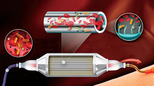 Oregon State University Researchers Build Novel Sepsis Filter | Peritoneal dialysis | Scoop.it
