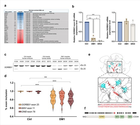 Un défaut d’épissage de SORBS1 altère la formation et la stabilité de la jonction neuromusculaire dans la dystrophie myotonique de type 1 | Life Sciences Université Paris-Saclay | Scoop.it