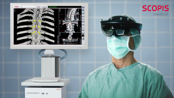 First Mixed-Reality Surgical Holographic Navigation with Microsoft HoloLens for Spine Surgery | WHY IT MATTERS: Digital Transformation | Scoop.it