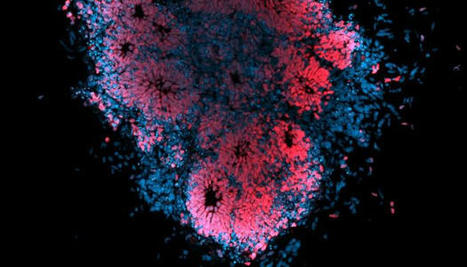 Researchers infect an organoid ‘brain in a dish’ in search for novel antivirals | Amazing Science | Scoop.it