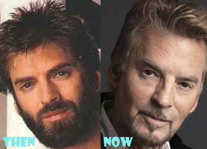 Kenny Loggins Plastic Surgery Before After Pictures | Celebrity Plastic Surgery | Scoop.it