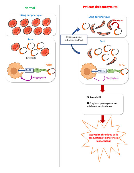 La protéine S facilite l’élimination des globules rouges lytiques : implications pour la drépanocytose | Life Sciences Université Paris-Saclay | Scoop.it