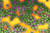 Le papillomavirus humain associé à une maladie auto-immune | actualités VIH, hépatites, IST, santé sexuelle | Scoop.it