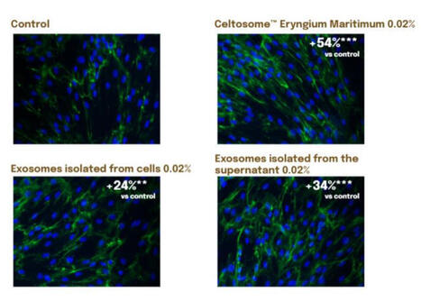 Seppic relie la quantit&eacute; d&rsquo;exosomes &agrave; l&rsquo;efficacit&eacute; cosm&eacute;tique | Innovation Agro-activit&eacute;s et Bio-industries | Scoop.it