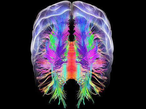 What Depression Looks Like In Your Brain | Positive Psychology | Scoop.it