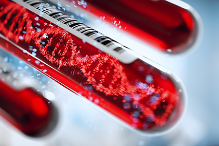 Liquid Biopsy – What’s real and what’s hype? | In-Vitro Diagnostic | Scoop.it