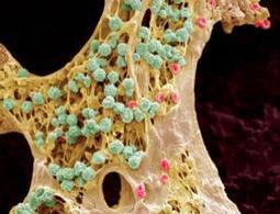 Cadaver stem cells offer new hope of life after death - health - 21 December 2012 - New Scientist | Longevity science | Scoop.it