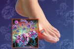 The Hip New Disease of 21st Century America Is… Gout | Physical and Mental Health - Exercise, Fitness and Activity | Scoop.it