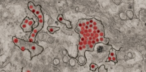 Virus Zika : premiers cas de transmission en France métropolitaine par le moustique-tigre | EntomoNews | Scoop.it