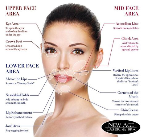 Dermal Fillers Near Me In New Age Medical Clinic Scoop It