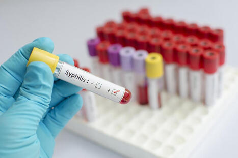 [Guyane] Syphilis dans l'Ouest : la pr&eacute;vention est-elle suffisante ? | actualit&eacute;s VIH, h&eacute;patites, IST, sant&eacute; sexuelle | Scoop.it