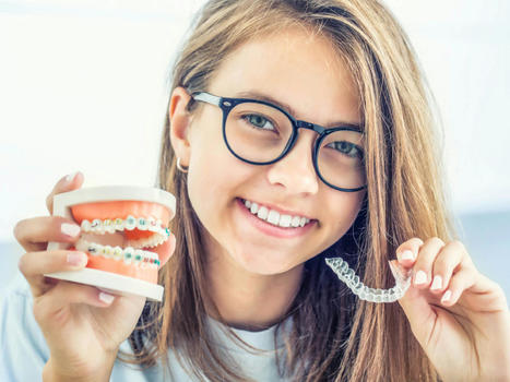 Benefits of Choosing Clear Aligners Over Traditional Braces | Smilepoint Dental Group | Scoop.it