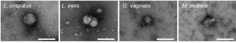 Vaginal bacteria-derived extracellular vesicles diffuse through human cervicovaginal mucus to enable bacterial signaling to upper female reproductive tract tissues | Brvm | RMH | Scoop.it