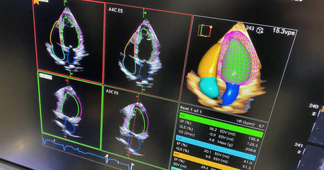 Cardiology now has more than 100 FDA cleared AI algorithms; experts say that is just the beginning | #Innovation dans le #cardiovasculaire - #Cardiovascular #Innovation | Scoop.it