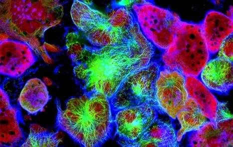 DNA typos to blame for most cancer mutations? | Life Sciences Universit&eacute; Paris-Saclay | Scoop.it