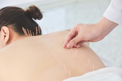 How Acupuncture Can Help with Low Back Pain | Call: 915-850-0900 | Chiropractic + Wellness | Scoop.it