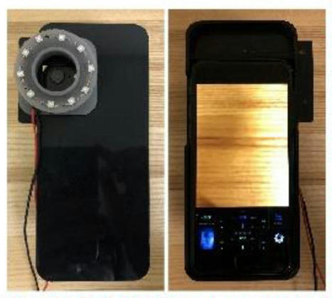 Smartphone images identify acne and mouth bacteria | healthcare technology | Scoop.it