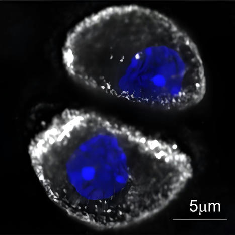 Research identifies protein that protects healthy joints from osteoarthritis | Rheumatology-Rhumatologie | Scoop.it