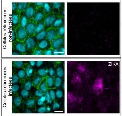 Le virus Zika infecte la rétine humaine | EntomoNews | Scoop.it