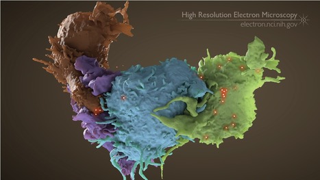 Nonviral CAR-T is ‘remarkably safe’ and clinically active in B-cell ALL | Vectorology - GEG Tech top picks | Scoop.it