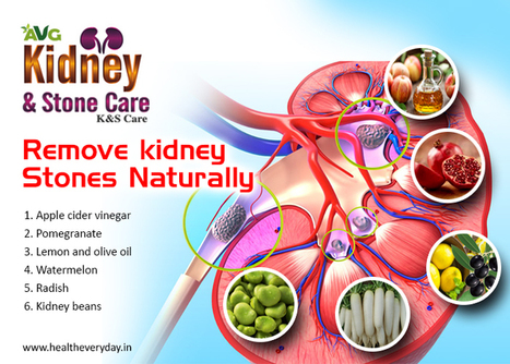 how to get rid of kidney stones naturally