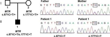 Patients with cobalamin G or J defect missed by the current newborn screening program: diagnosis and novel mutations | dépistage néonatal | Scoop.it