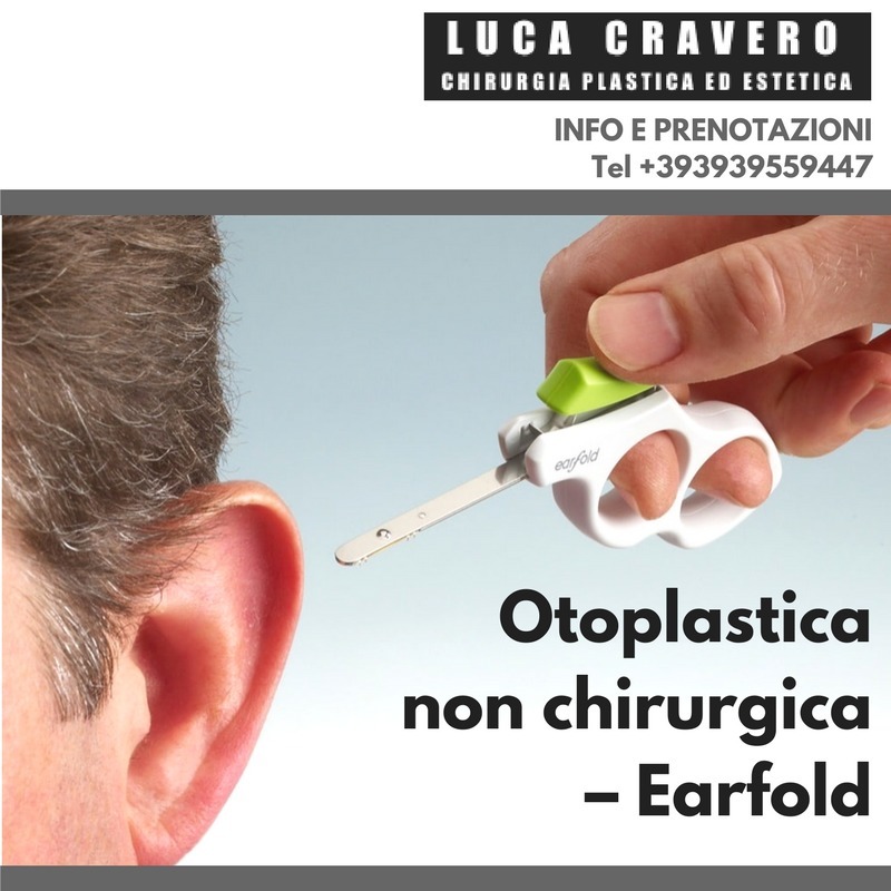 Otoplastica non chirurgica - Earfold