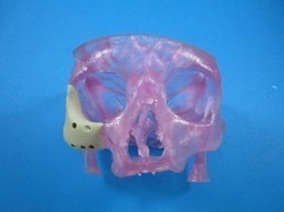 FDA-Approved 3D Printed Facelift is a First | Inside3DP.com | Digital-News on Scoop.it today | Scoop.it