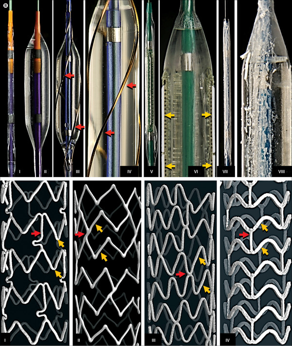 New Drug-Eluting Balloon May Be as Safe and Effective as Conventional Metal Stents for Repeat Percutaneous Coronary Interventions | Interventional Cardiology | Scoop.it