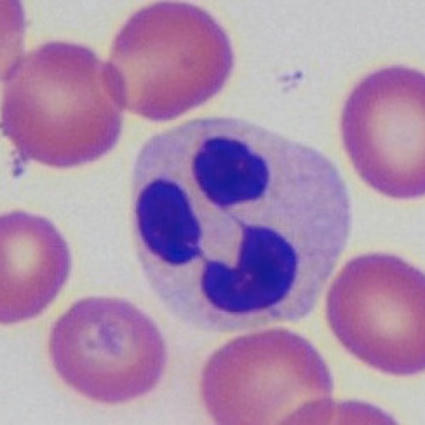 Continuing Professional Development - Haematology and cytology online | CME-CPD | Scoop.it